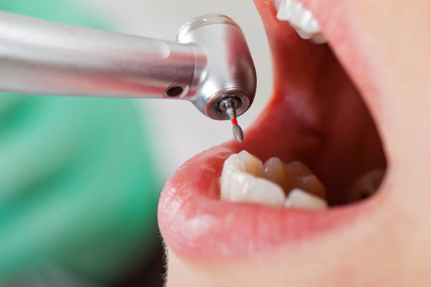 Best Emergency Treatment for Toothache in Lawndale, CA